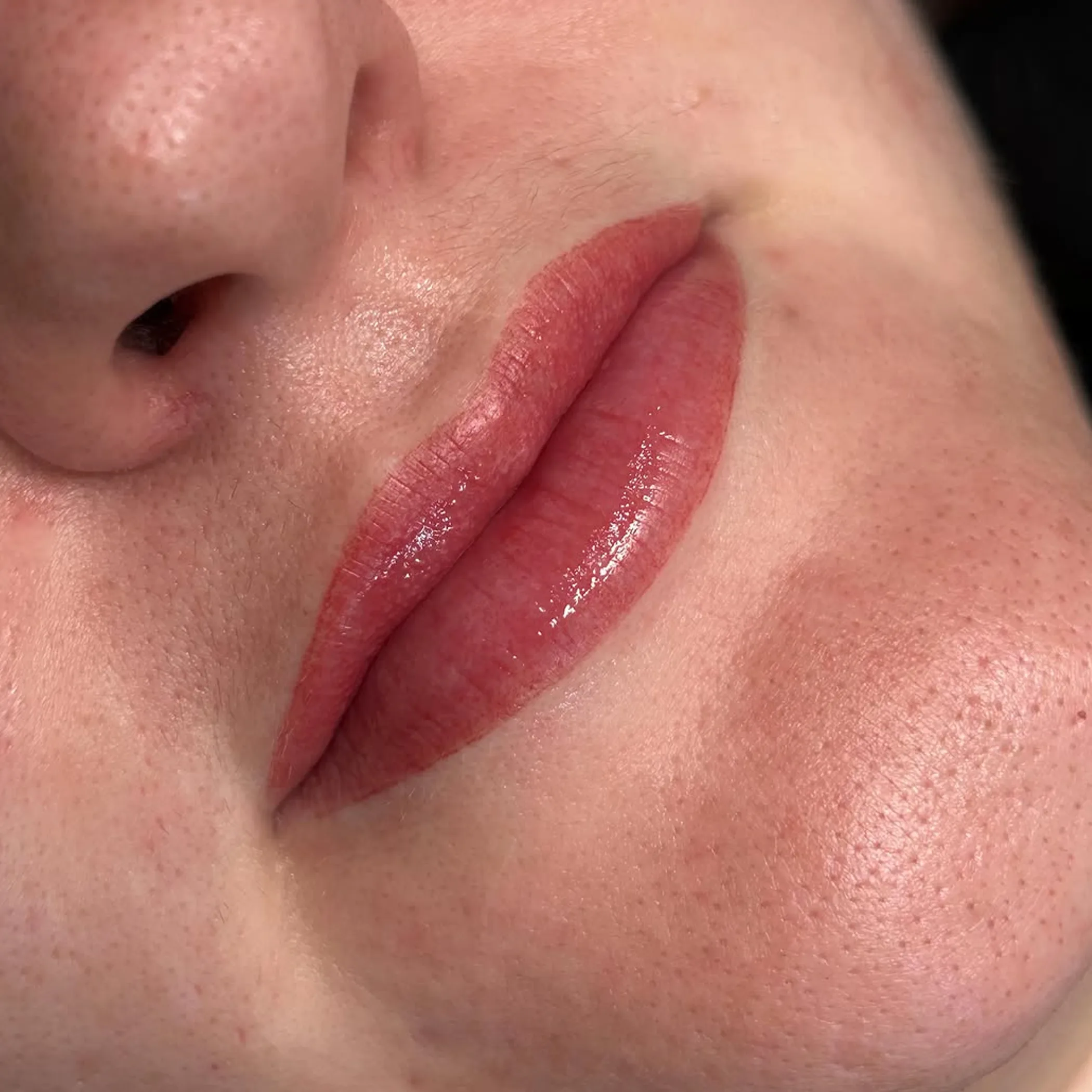 cosmetically enhanced lips